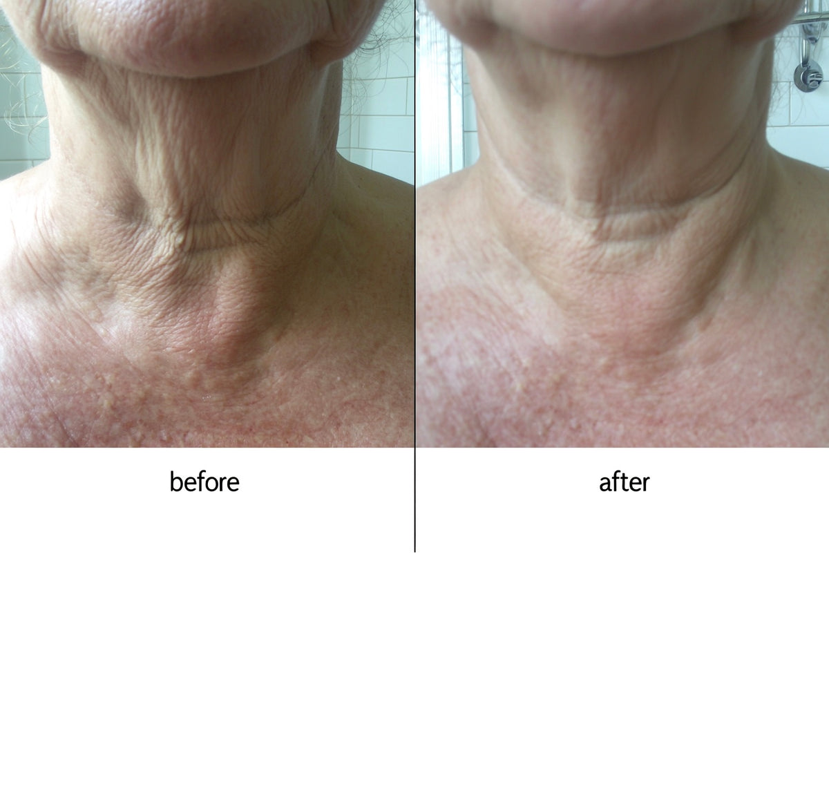Dermvia Tighten & Lift Neck Cream™